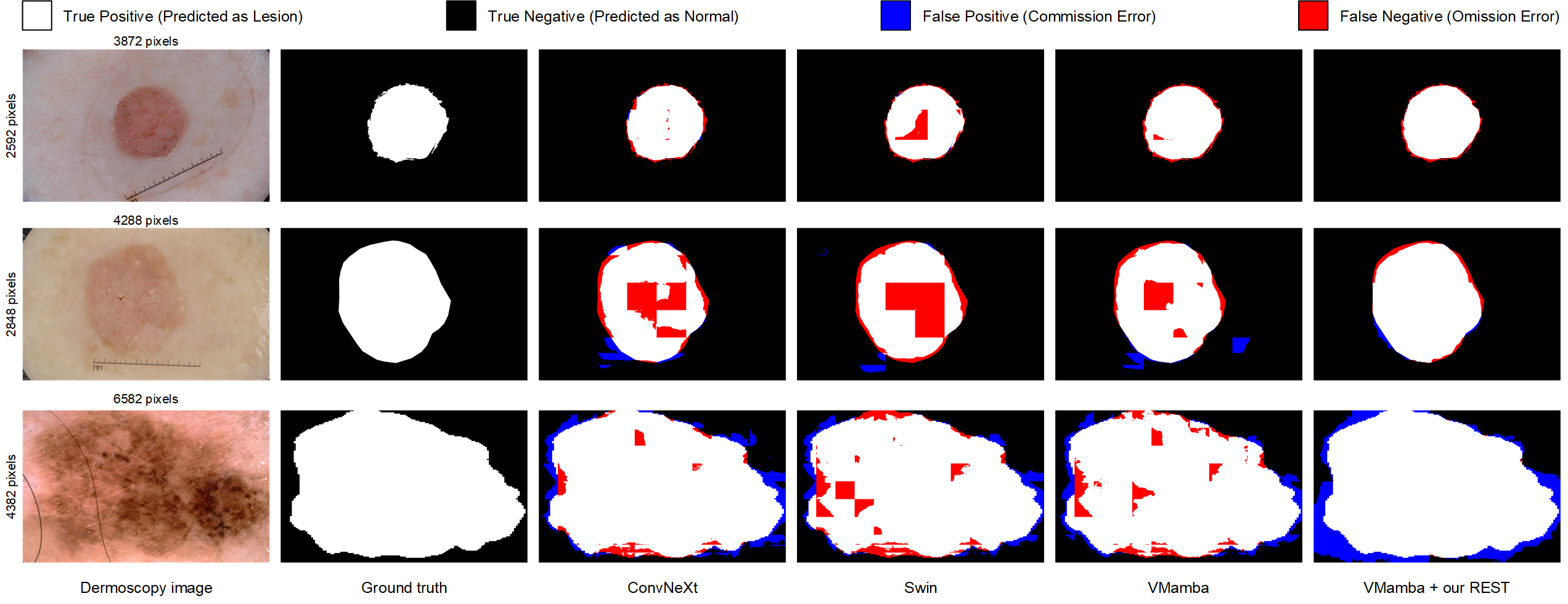 Visualization of preliminary results on the ISIC dataset